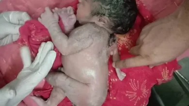فیلم و عکس تولد نوزاد پسر با سه دست در هندوستان همه را شوکه کرد