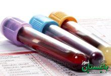 آزمایش ایرانی