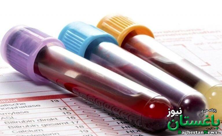 آزمایش ایرانی